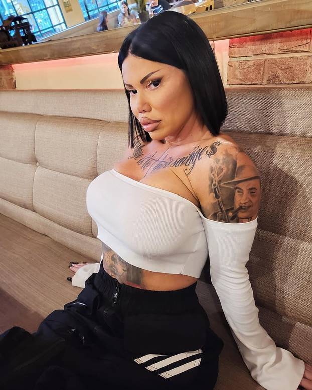 FOTO Sudionici reality showa na dvorištu pukao silikon stražnjice