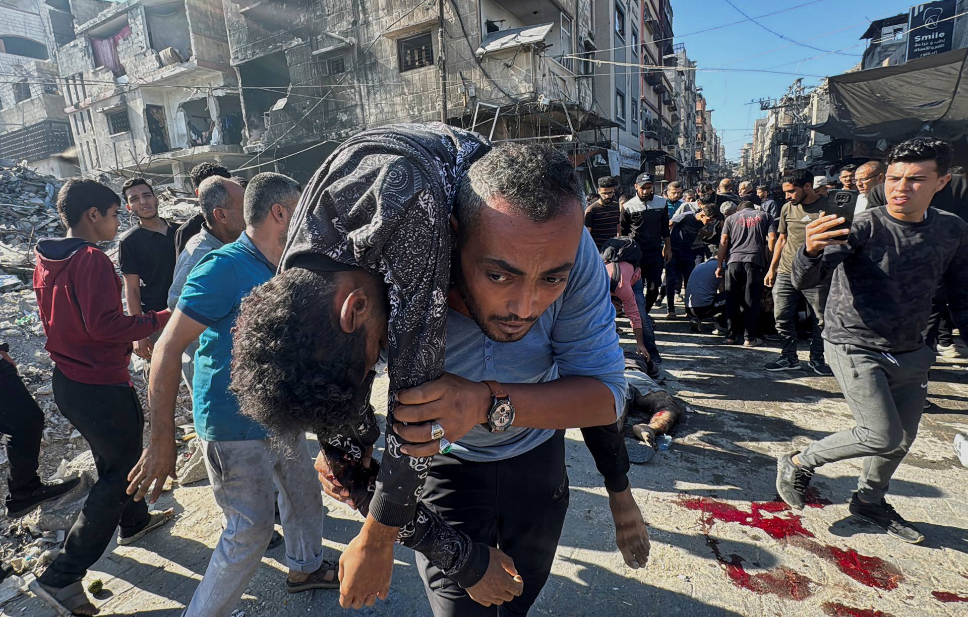 Palestinians assist casualties following an Israeli strike, in Beit Lahiya