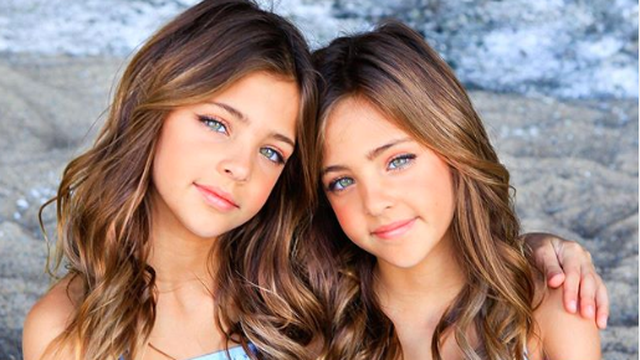Upoznajte Avu i Leah (9): Jesu li ovo najljepše blizanke svijeta