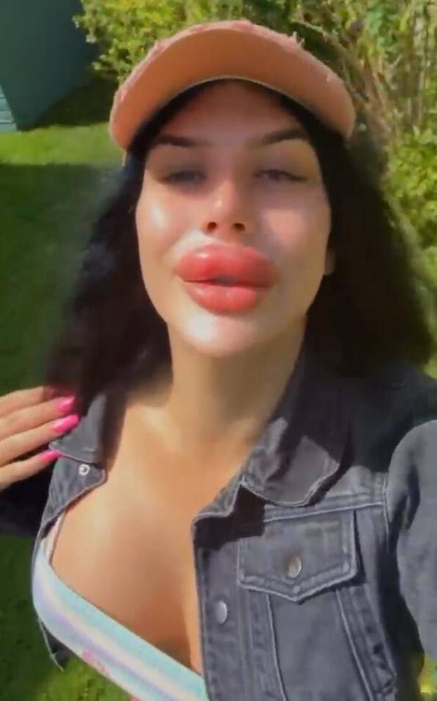 Woman with Britain's ‘biggest lips’ injects filler at HOME after being ‘refused’ by professionals – despite only taking six-week online course