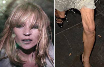 Pijana Kate Moss izgleda kao anoreksična sablast