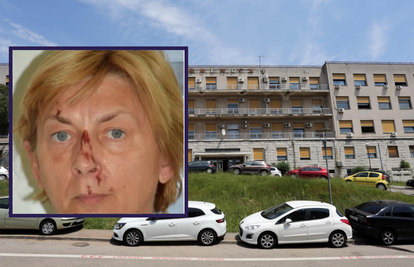 VIDEO U ovoj bolnici leži Dana Adamcova, slovačka turistkinja kojoj su 24sata otkrila identitet
