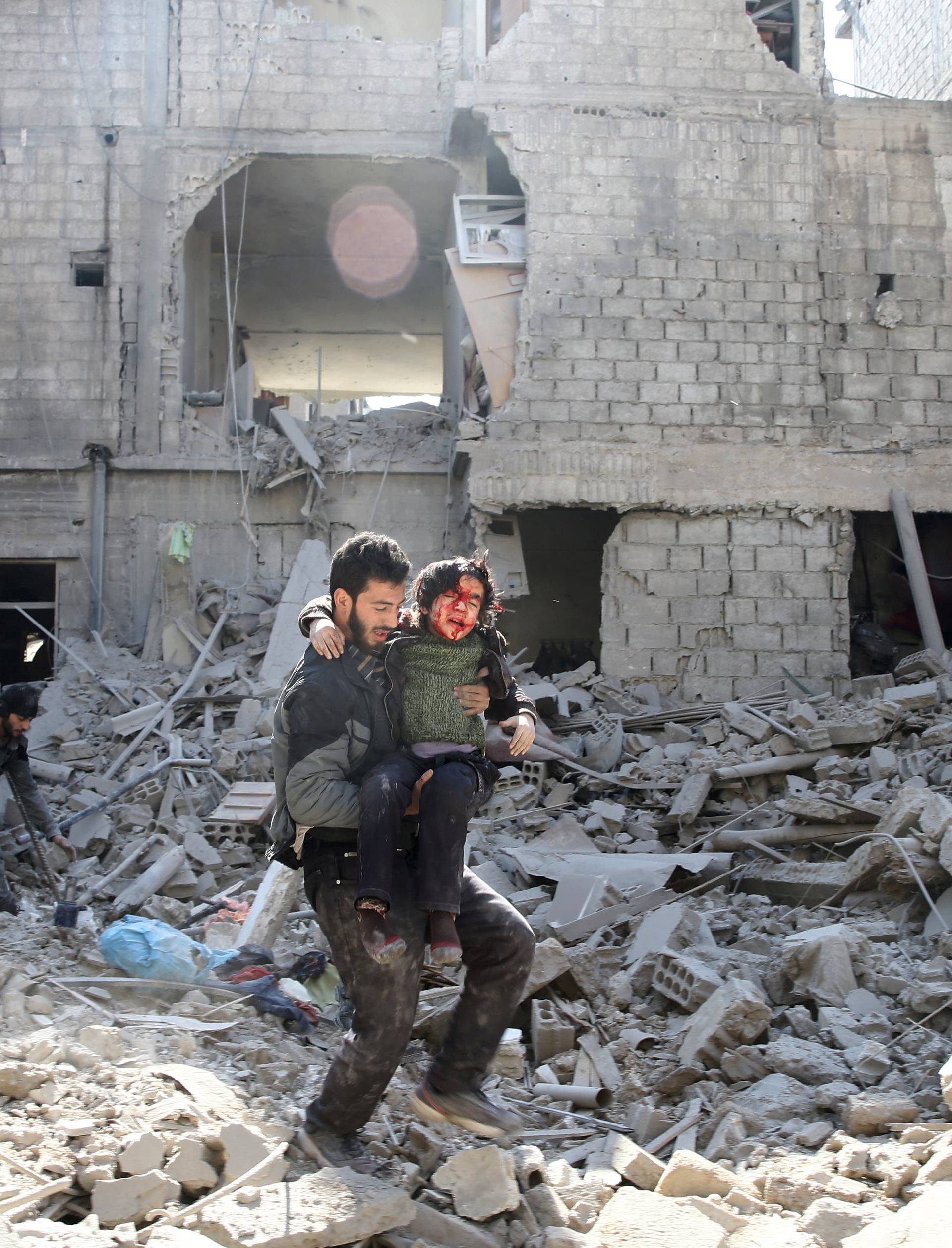 A man carries an injured boy as he walks on rubble of damaged buildings in the rebel held besieged town of Hamouriyeh