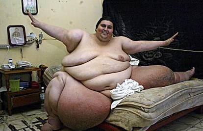 Najdeblji čovjek na svijetu smršavio 230 kilograma