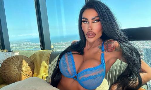 FOTO Potrošila više od 100 tisuća eura kako bi izgledala kao 'ljudska barbika' - Liječnici zgroženi