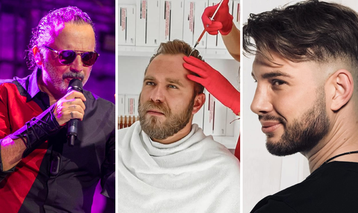 FOTO Zbogom, &cacute;elavosti! Ovi su slavni mu&scaron;karci presadili kosu