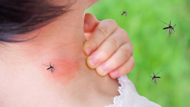 8 načina kako efikasno smanjiti svrbež nakon ugriza kukaca