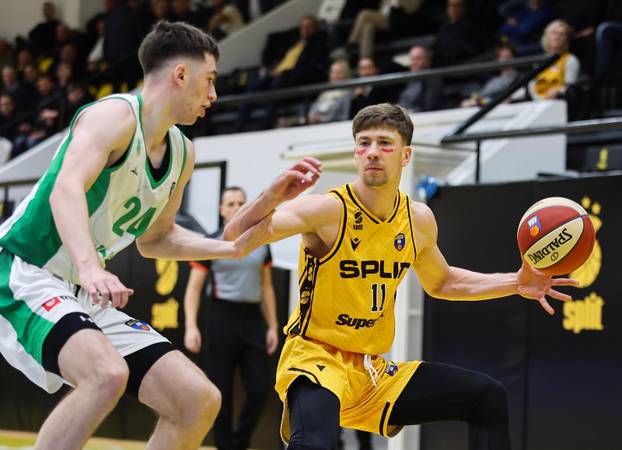 Split: Košarkaši igrali "našminkani" u znak podrške Međunarodnom danu borbe protiv nasilja nad ženama