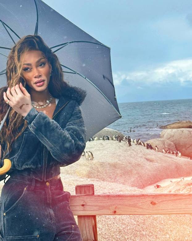 FOTO Rugali su joj se zbog bolesti, a danas je obožavaju zbog jedinstvenog izgleda