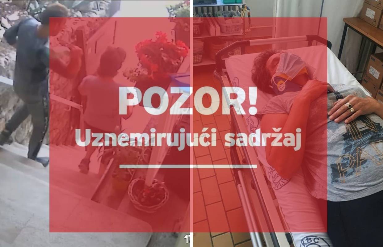 Brutalan napad u Splitu snimile kamere: Ženu udario bocom i nastavio mlatiti na stepenicama