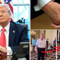 FOTO Trump ima veliku modricu na desnoj ruci. Bijela kuća tvrdi: 'To je od rukovanja, ne terapije'