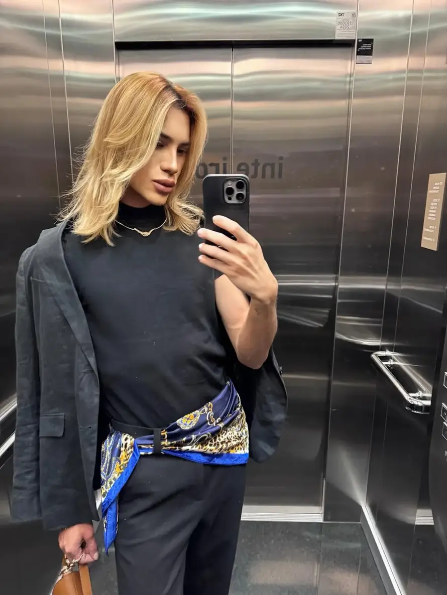 Preminuo poznati influencer: Htio je 'mačji' izgled, a tvrdio je da mu je oči operirao zubar