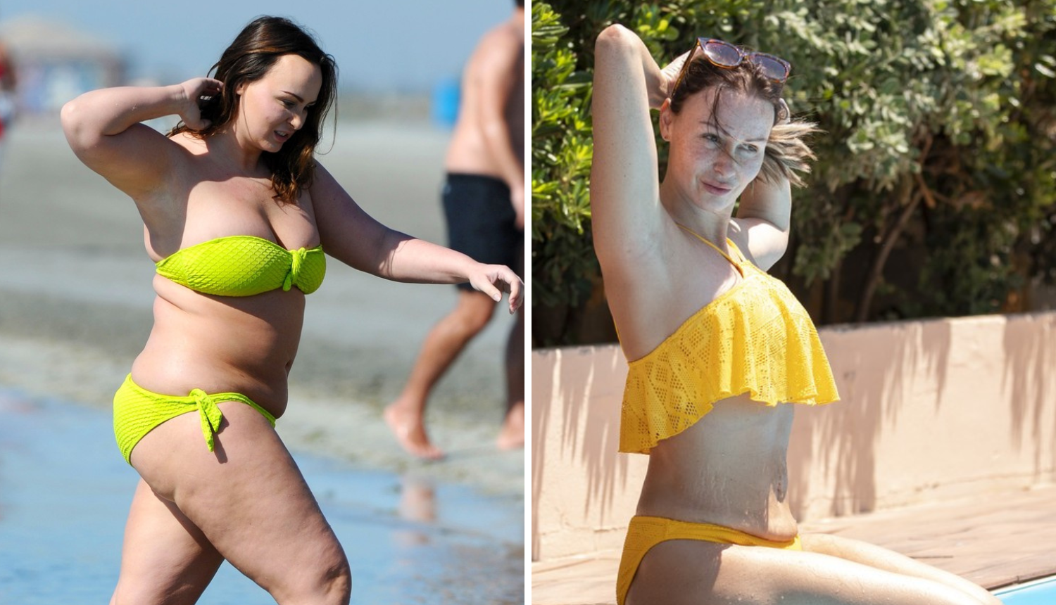 Kako bi izgledala 'mršavo poput Victorije Beckham' otišla je na operaciju želuca i skinula 57 kila