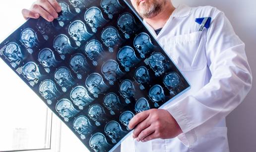 Nije im lako: Nevidljiva bolest od koje pati 7000 Hrvata