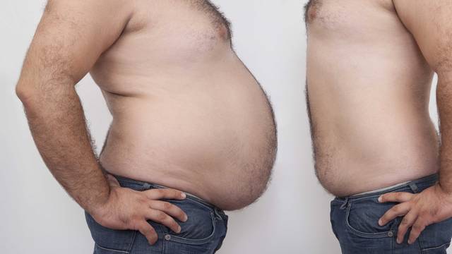 Izgubio više od 100 kg i tvrdi: Dijetama nećete ništa postići