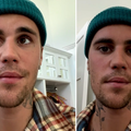 Bieber zabrinuo obožavatelje: 'Kao što vidite ne mogu se nasmijati i ne mogu trepnuti'