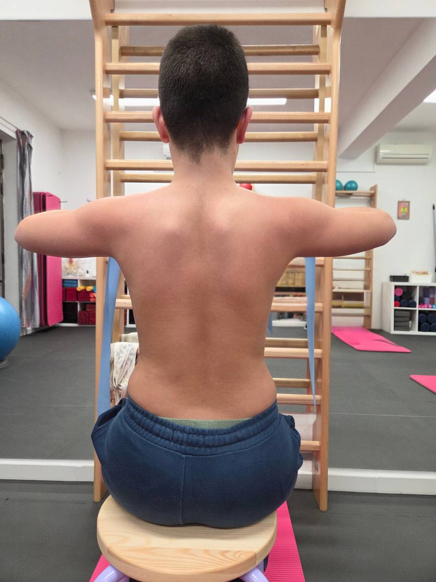 Skolioza kod djece: što roditelji najčešće primijete prekasno i kako reagirati?