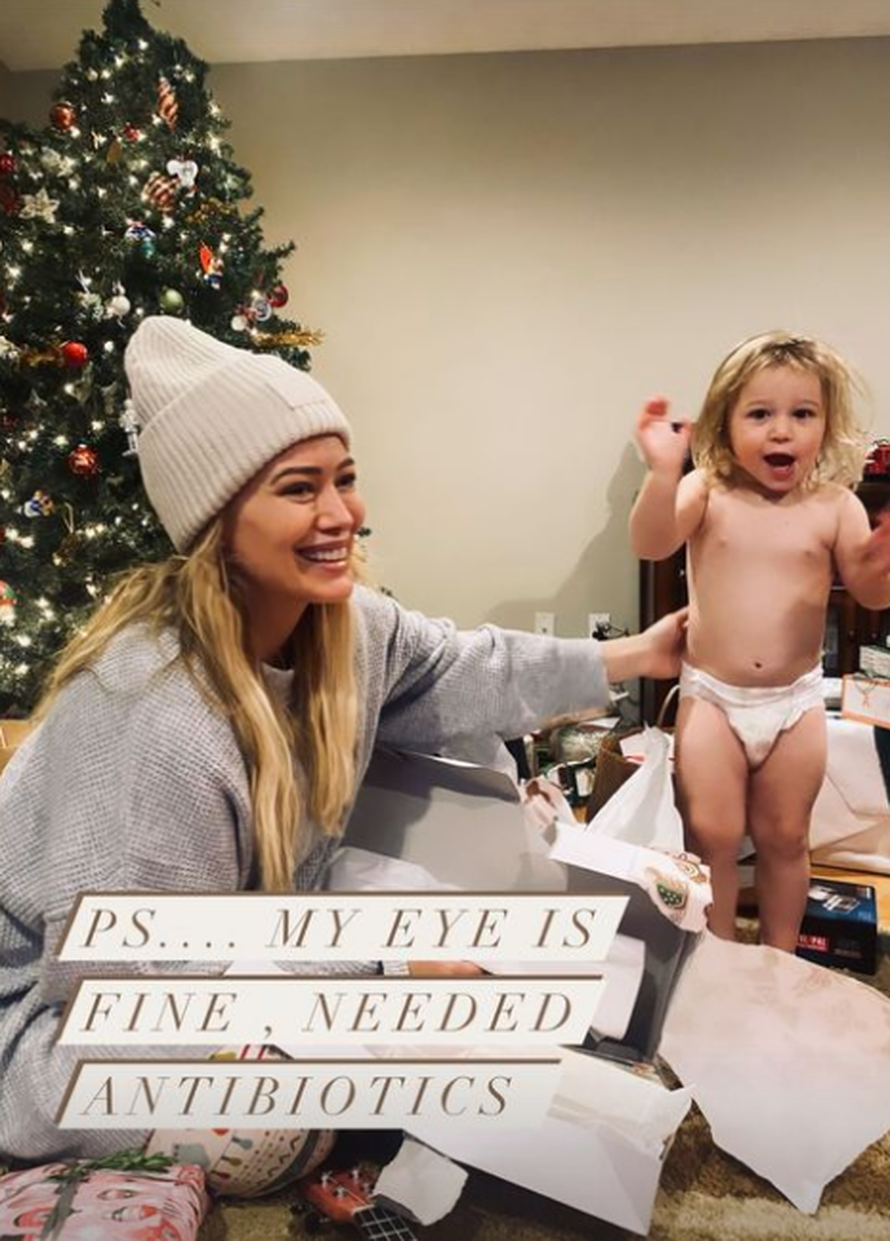 Hilary Duff: Testirala sam se na korona virus i nateklo mi je oko