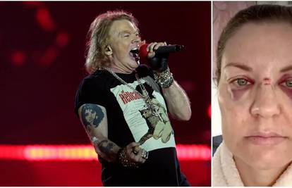 Axl Rose mikrofonom pogodio obožavateljicu: Prvo se ispričao pa obećao da se neće ponoviti