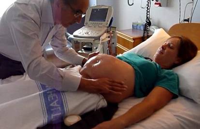'Šaptač bebama': Ginekolog je rukama okrenuo bebu u utrobi