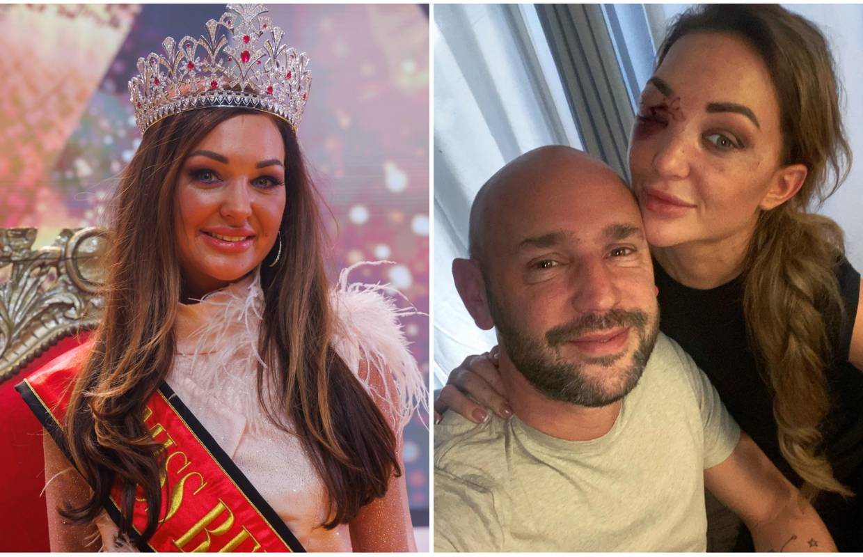 Miss Belgije imala prometnu, pola sata su je izvlačili iz auta