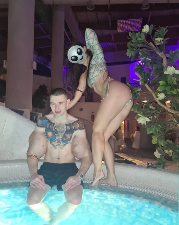 FOTO 'Ruski Popaj' mogao bi izgubiti obje ruke zbog teške infekcije: Ubrizgava kemikalije!