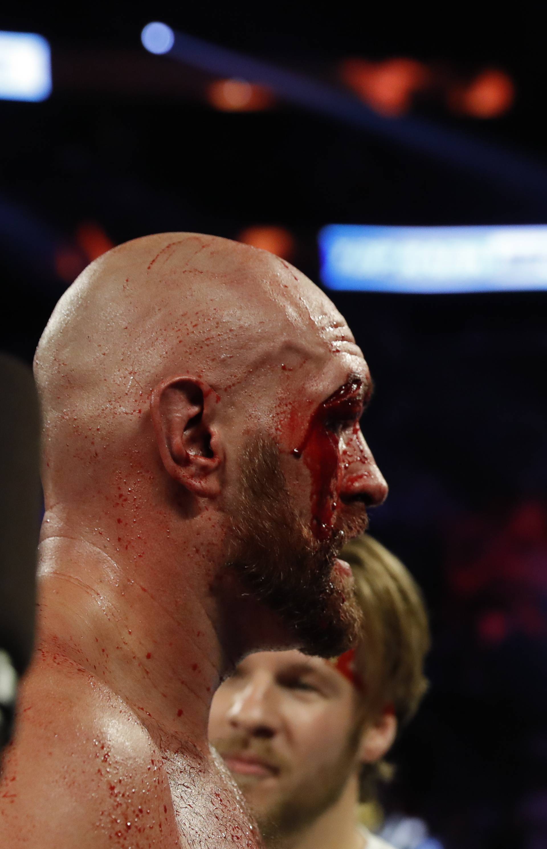 Tyson Fury v Otto Wallin