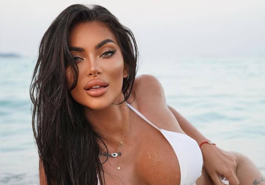 Kako su Soraja, Hana i Kristina izgledale prije odlaska pod nož?