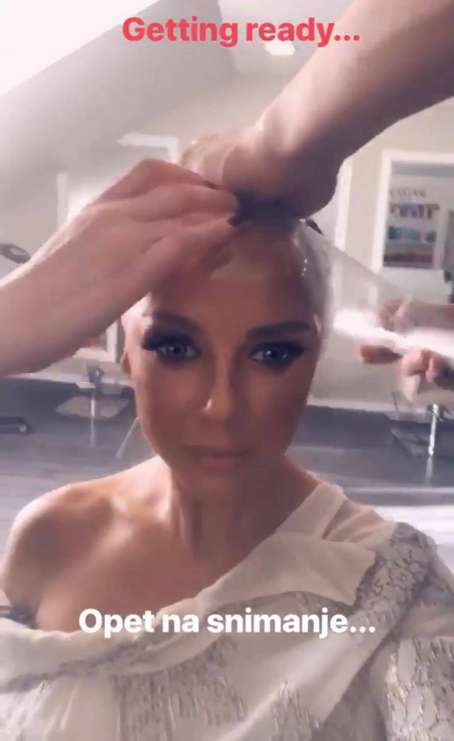 Severina se više ne botoksira, a Šuput se unakazila filerima