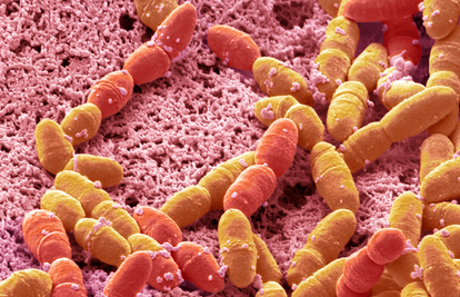 Šestero djece u Britaniji umrlo od infekcije bakterijom Strep A