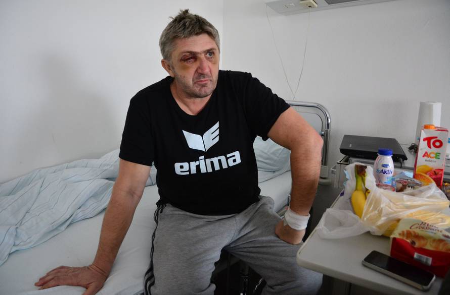 Pretučeni zaštitar: Napad u diskoteci sam jedva preživio