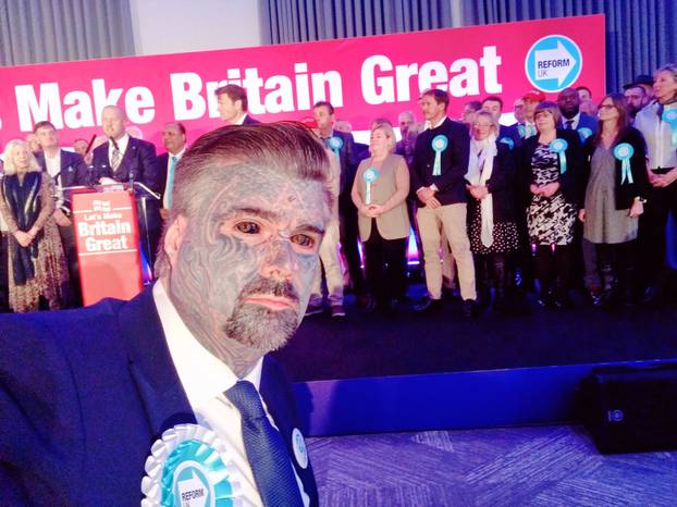 FOTO Više mu ne stane nijedna tetovaža! Uklonio je i bradavice. Evo kako je prije izgledao: Wow