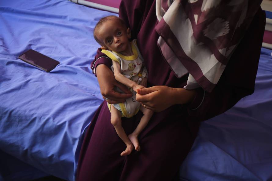 Palestinian children suffering from malnutrition receive medical care at Al-Rantisi Children's Hospital