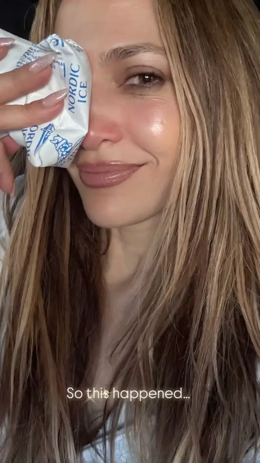 FOTO Gadna ozljeda lica Jennifer Lopez: U pomoć joj priskočio poznati estetski kirurg