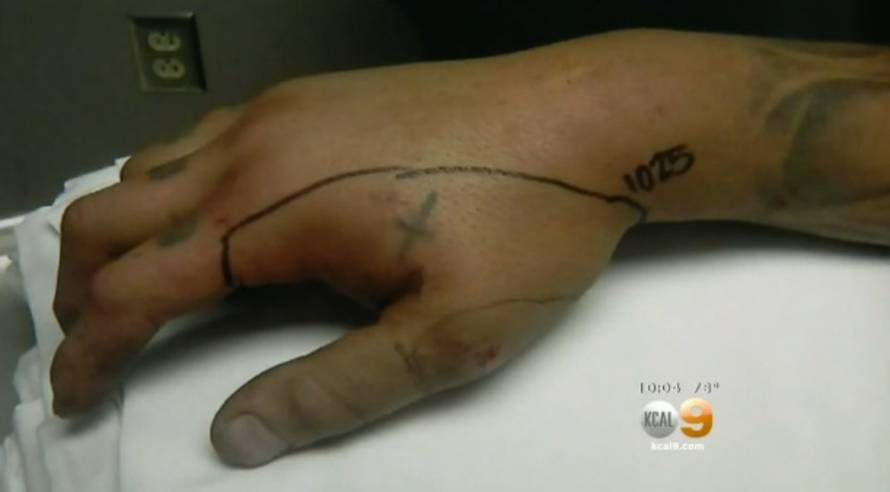 Screenshot/CBSLosAngeles