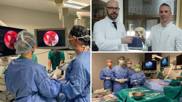 Liječnici KBC-a Zagreb tumore u lubanji operiraju kroz nos: 'To je savršen put do našeg mozga'