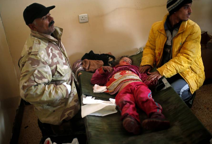 An Iraqi girl, who was wounded during clashes in the Islamic State stronghold of Mosul, lies on a bed at a field hospital in al-Samah neighborhood, in Iraq