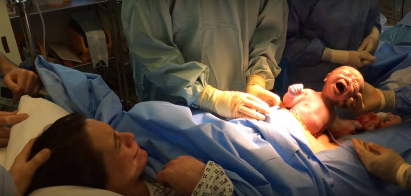 Prirodni carski rez: Doktori puste bebu da izmigolji sama