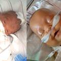 Rođen prerano i 'bez crijeva', liječnici su rekli da nema nade
