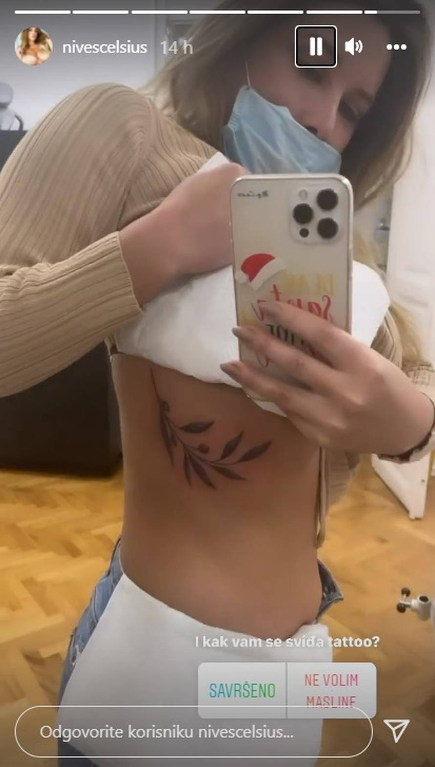 Nives otkrila masnicu na guzi: 'Je li se i vama ovako dogodi?'