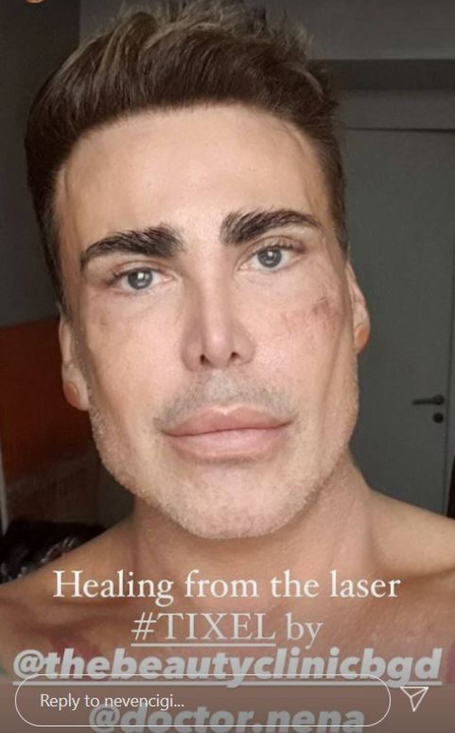 Cigi: 'Koža mi je dosta stradala u realityju pa sam se pomladio'