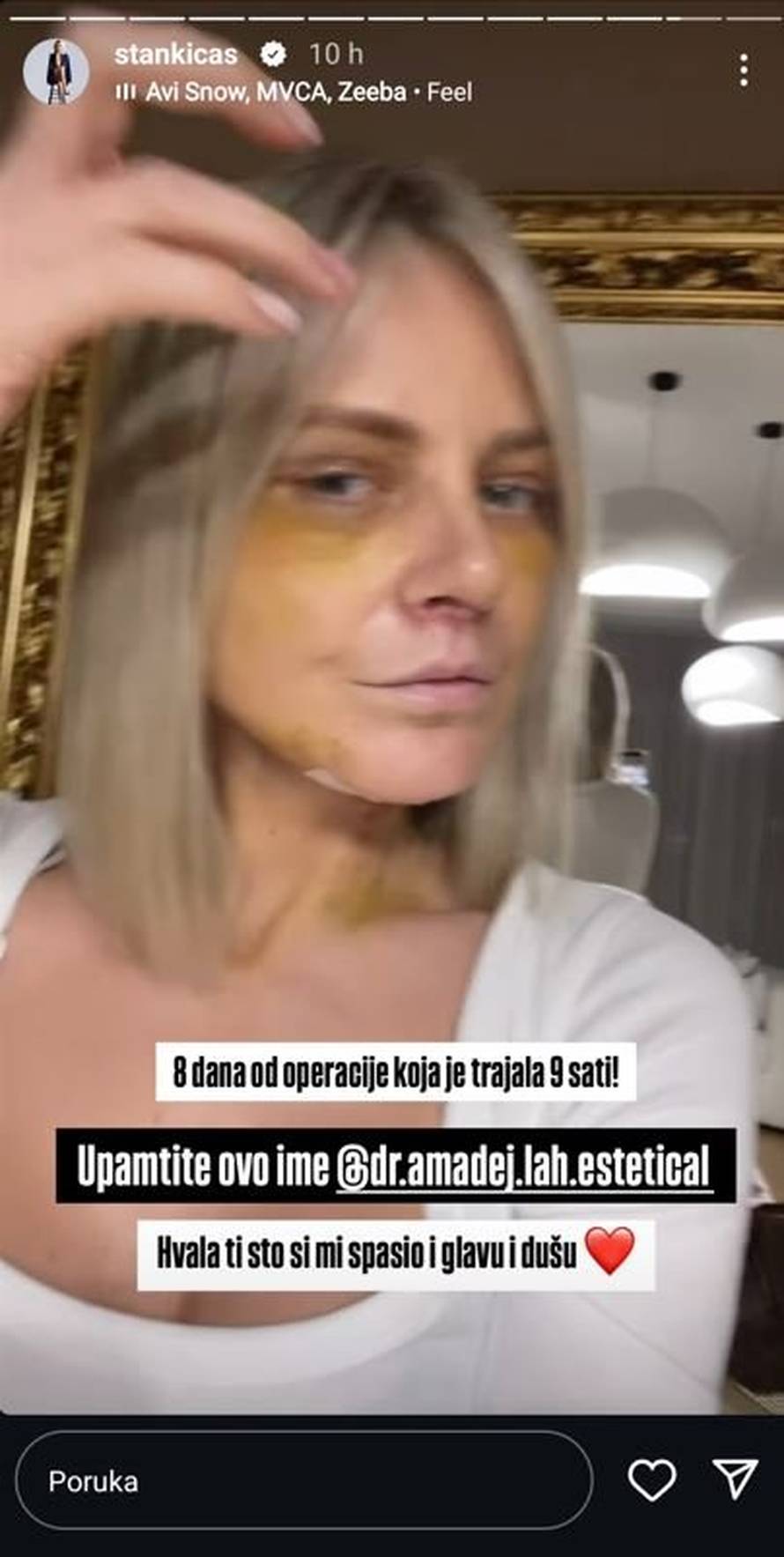 Stankica iz 'Savršenog' uklonila filere: Operacija je trajala 9 sati