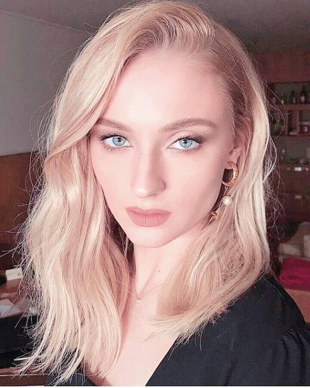 FOTO Potpuno su se izobličili: Radi popularnog zahvata brojni slavni izgubili su svoju ljepotu