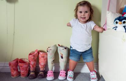 Dirljivi video: Hrabra djevojčica bez udova načinila prve korake