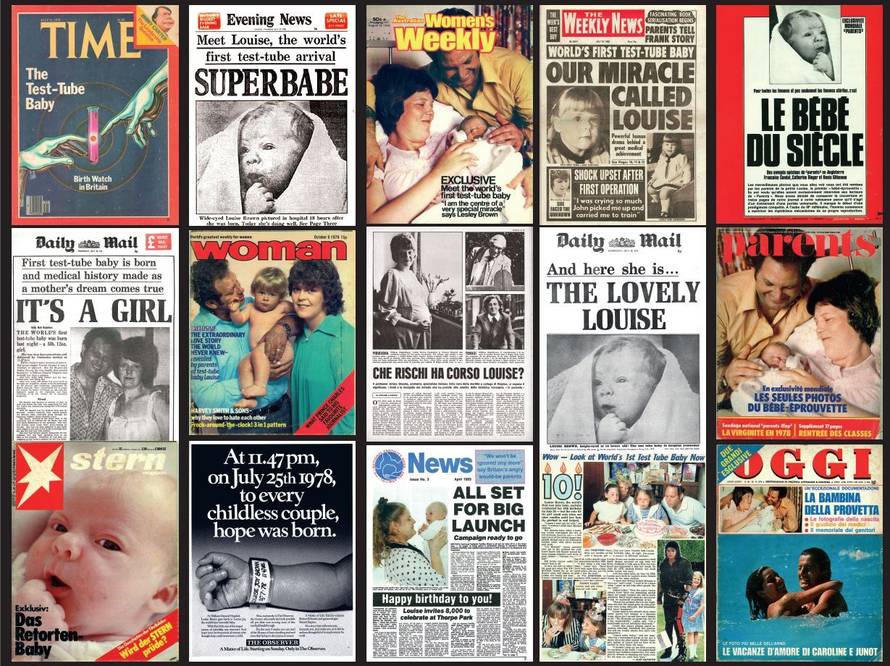 Plač koji je obišao svijet! Priča prve bebe iz epruvete: 'Moje rođenje bila je nada za mnoge'