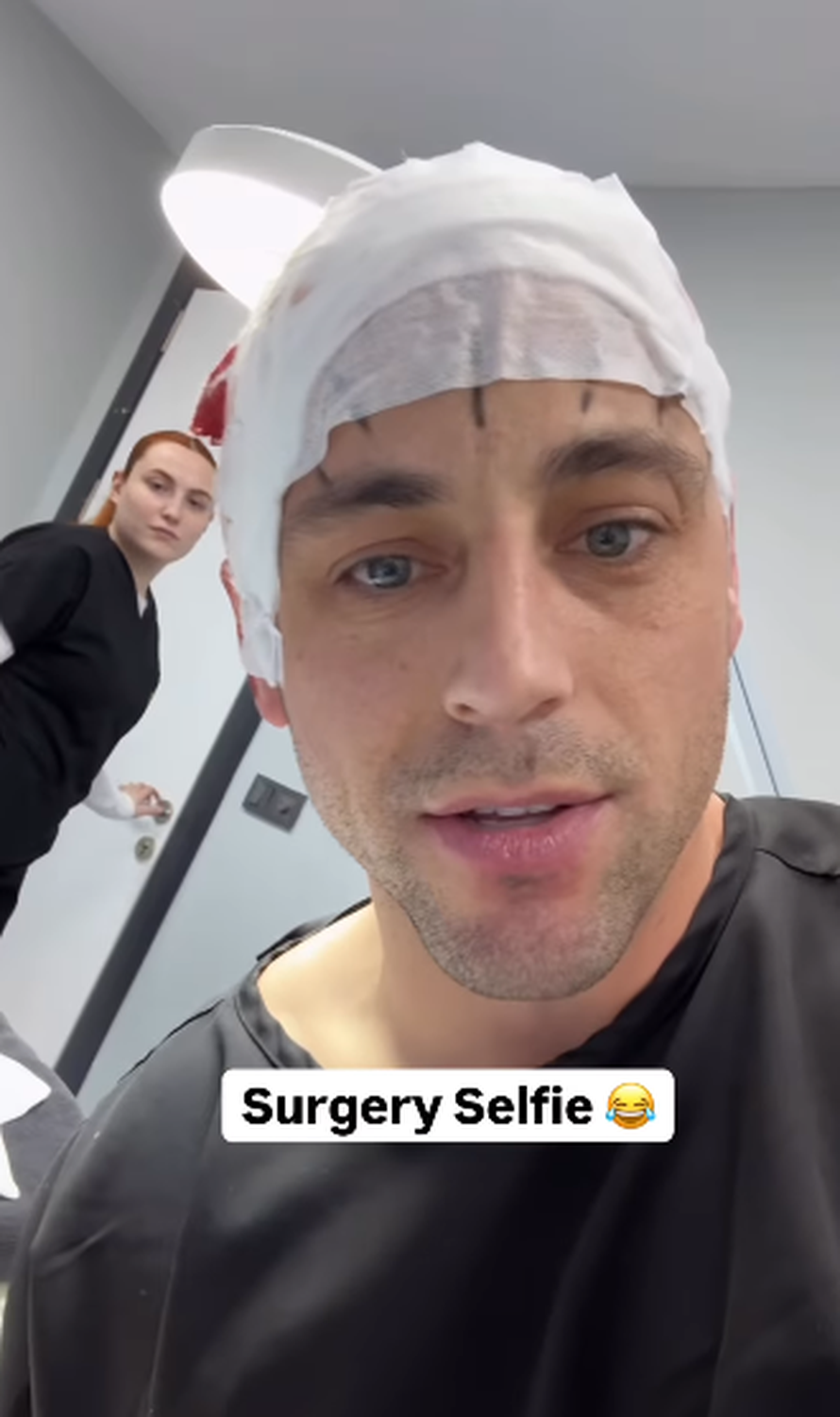 Trojčeki otputovali u Tursku na transplantaciju kose: 'Ne može samo jedan imati dobru frizuru'