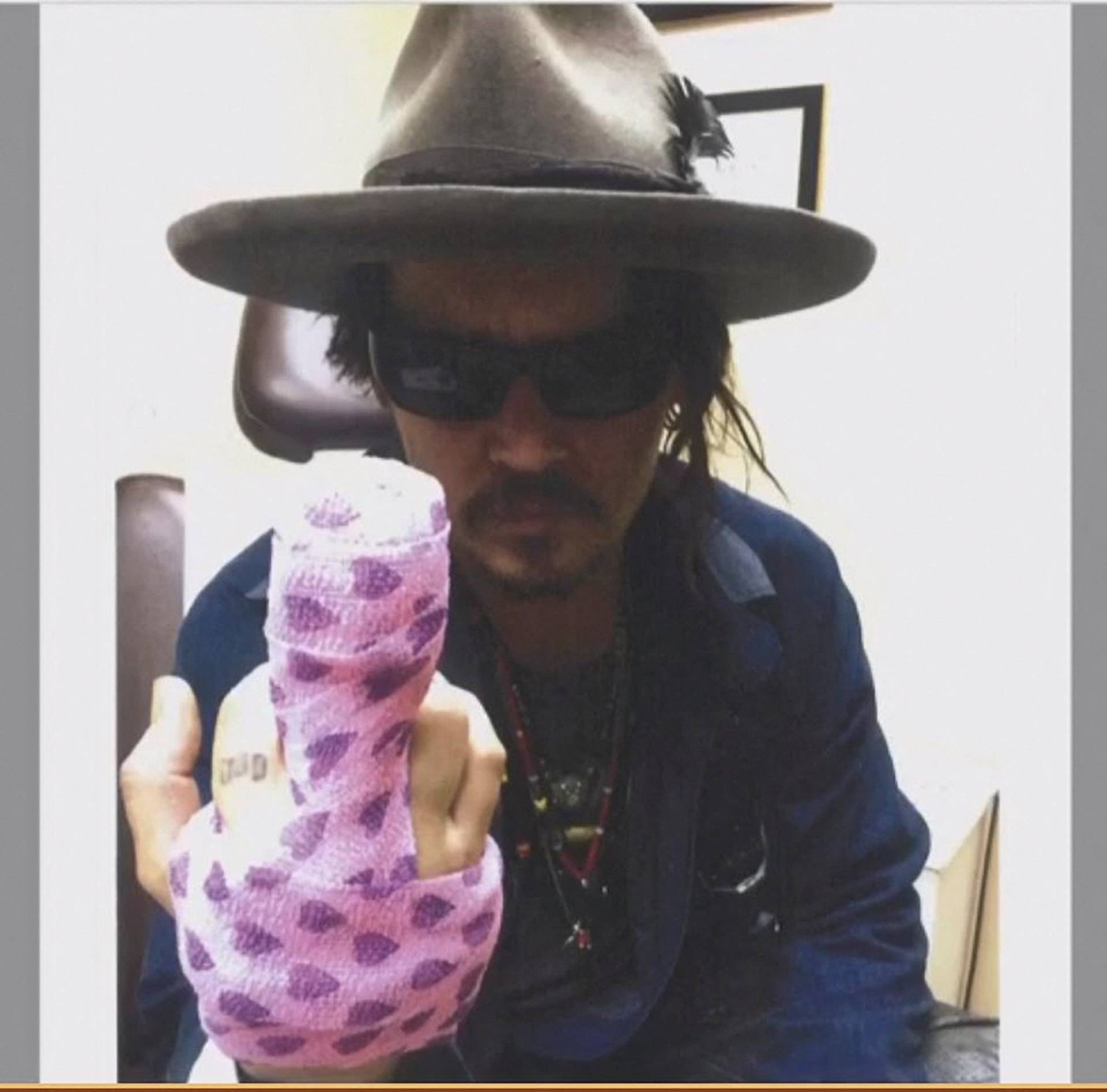 Courtroom evidence photograh shows actor Johnny Depp and bandaged finger