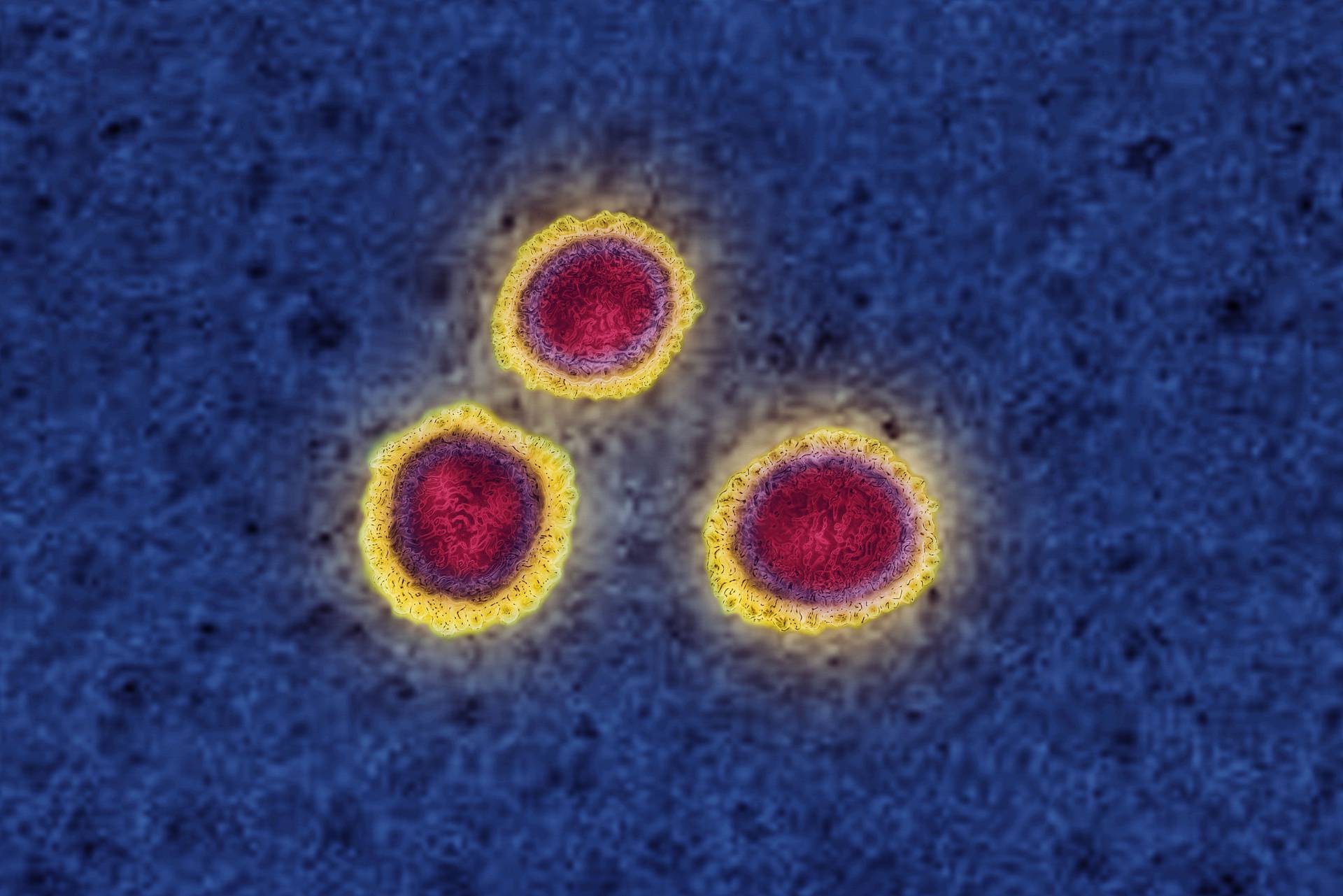 Coronavirus (CoV). virus of the family Coronaviridae and of the subfamily Orthocoronavirinae. It is a pathogen of respiratory syndromes. View from a transmission electron microscopy (TEM) image. Viral diameter 80nm to 100nm.
