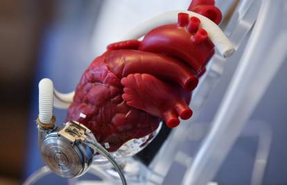 Njemački liječnici planiraju presaditi svinjsko srce čovjeku