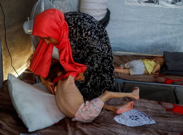 FILE PHOTO: Malnourished Palestinian children receive treatment at the IMC field hospital in Deir Al-Balah, central Gaza Strip